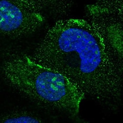 MAK16 Antibody, Novus Biologicals 0.1mL; Unlabeled:Antibodies, Polyclonal
